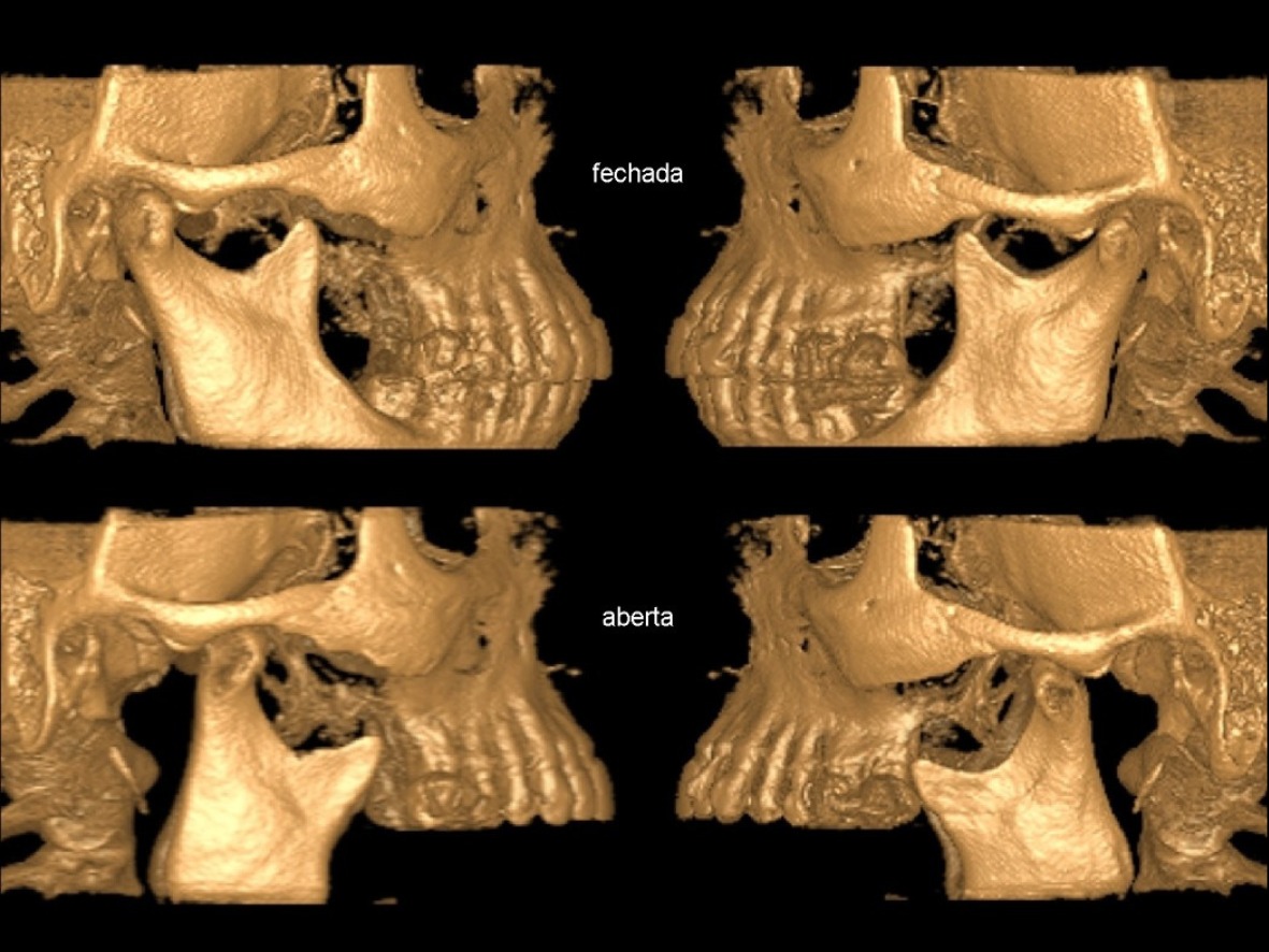 Radiografia