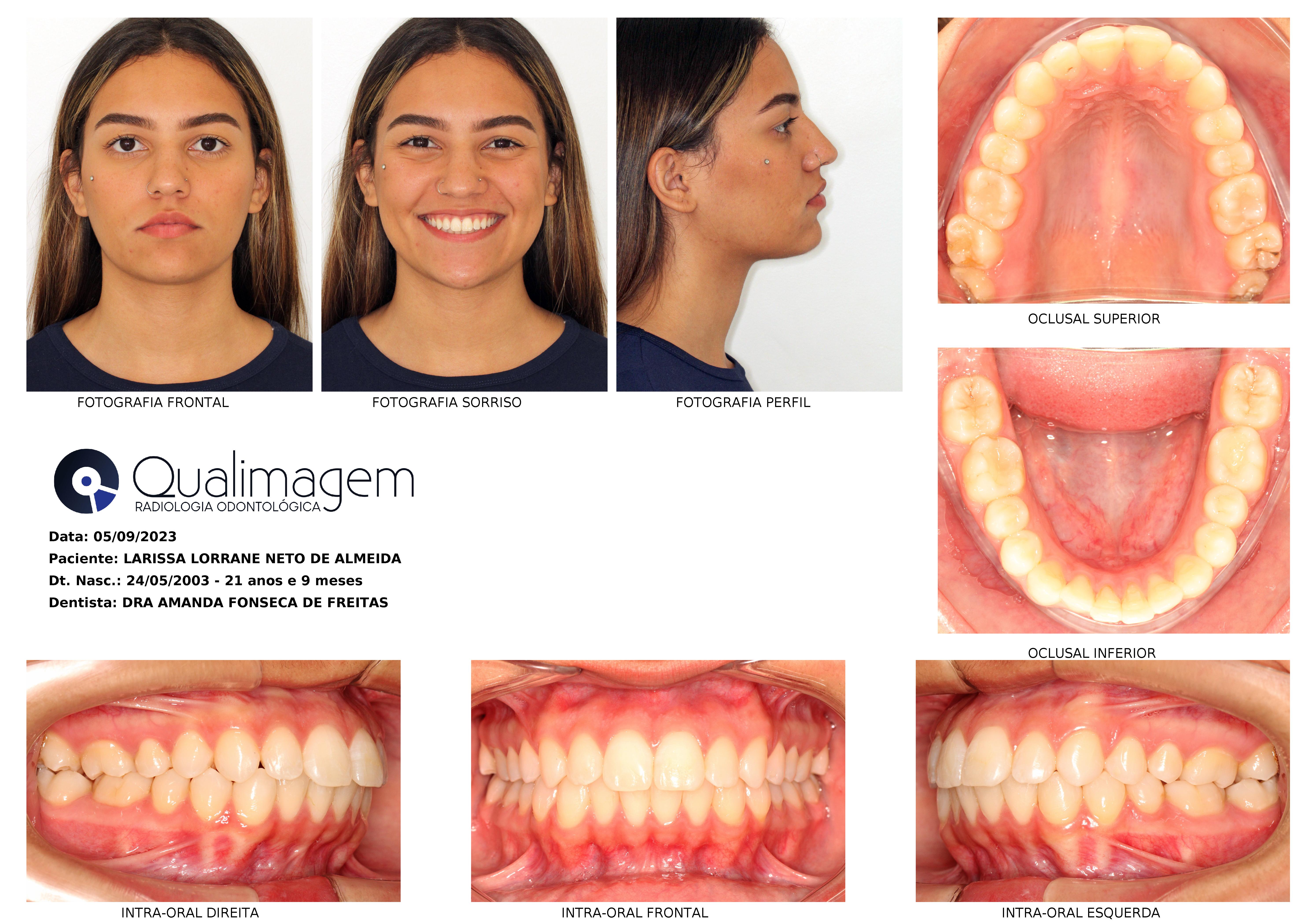 Radiografia