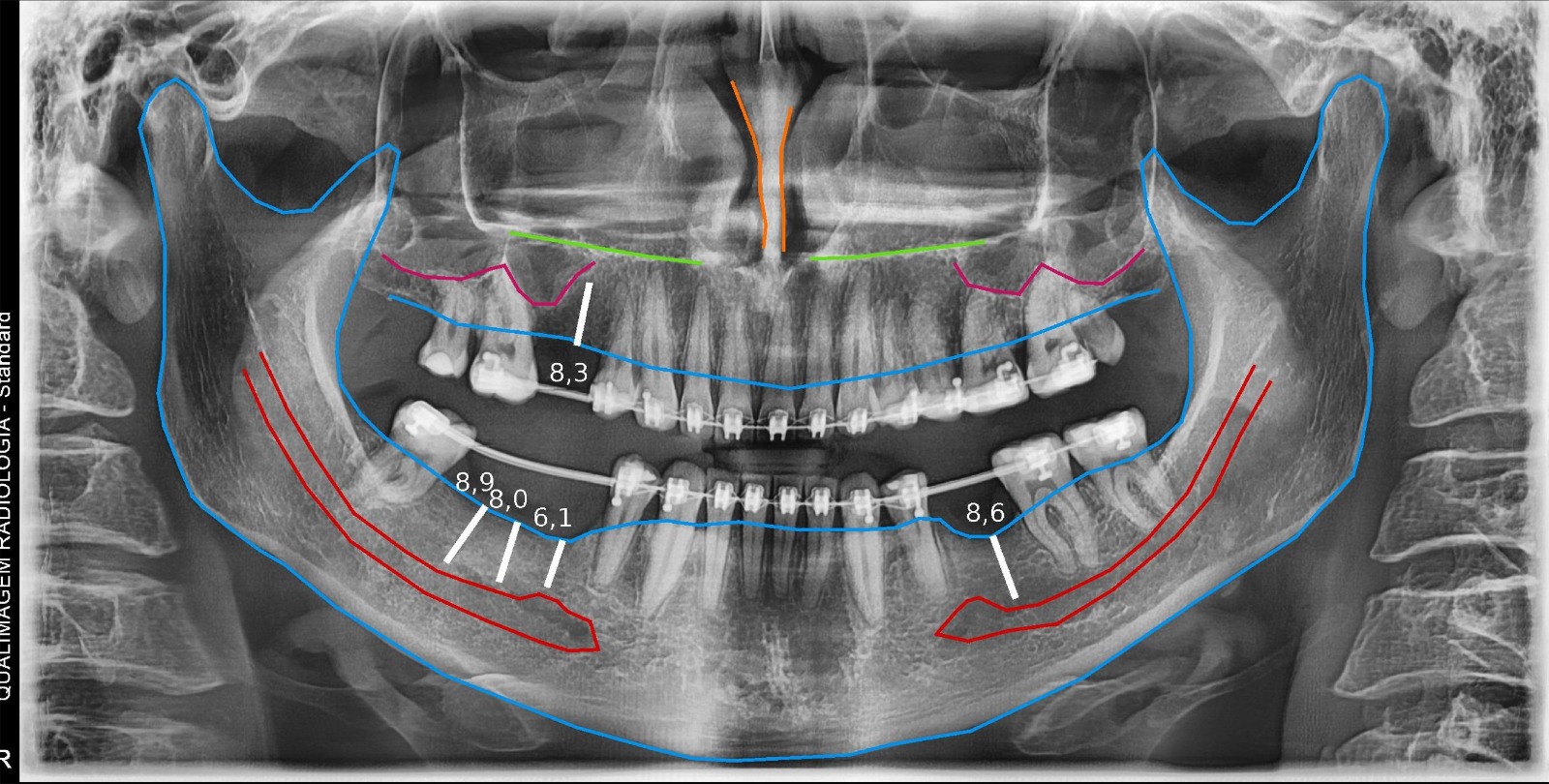 Radiografia