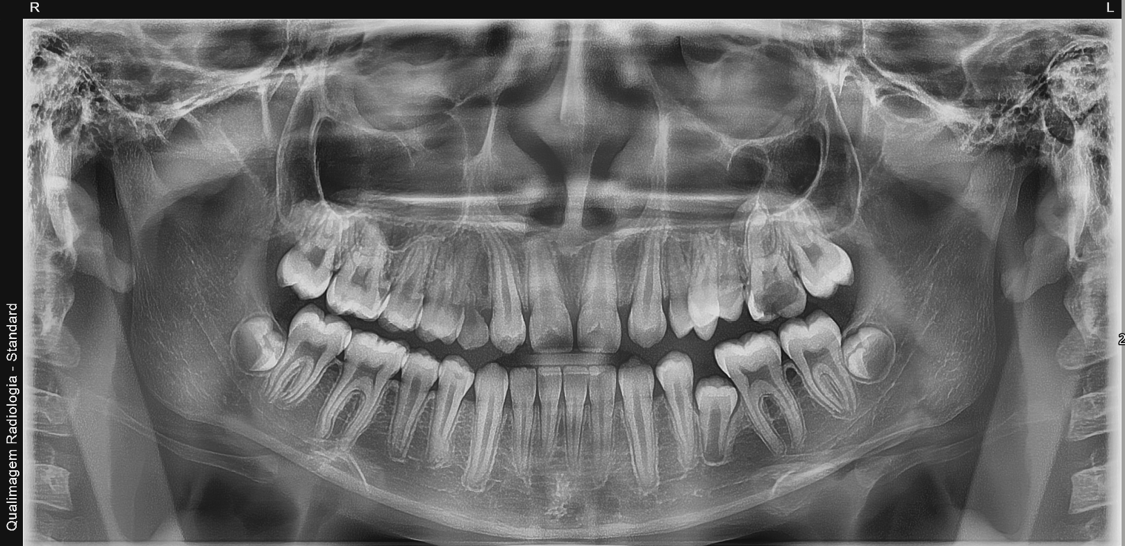 Radiografia