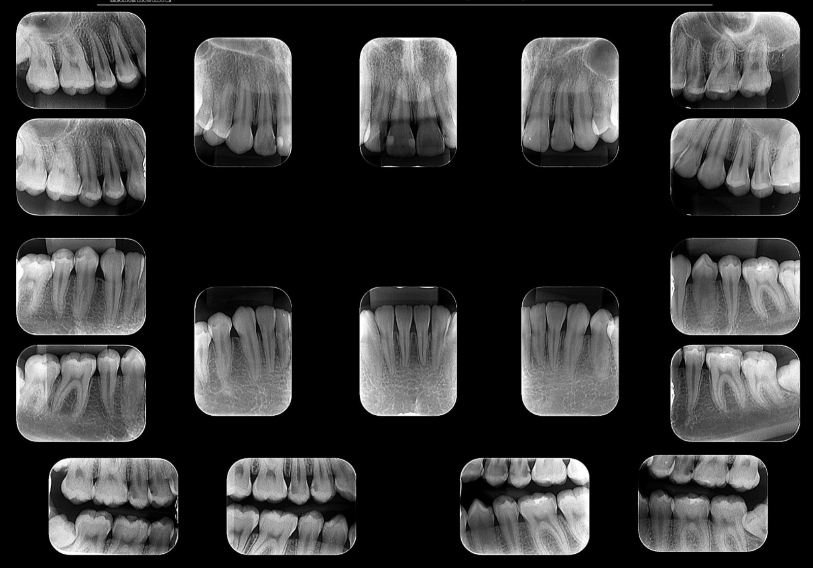 Radiografia