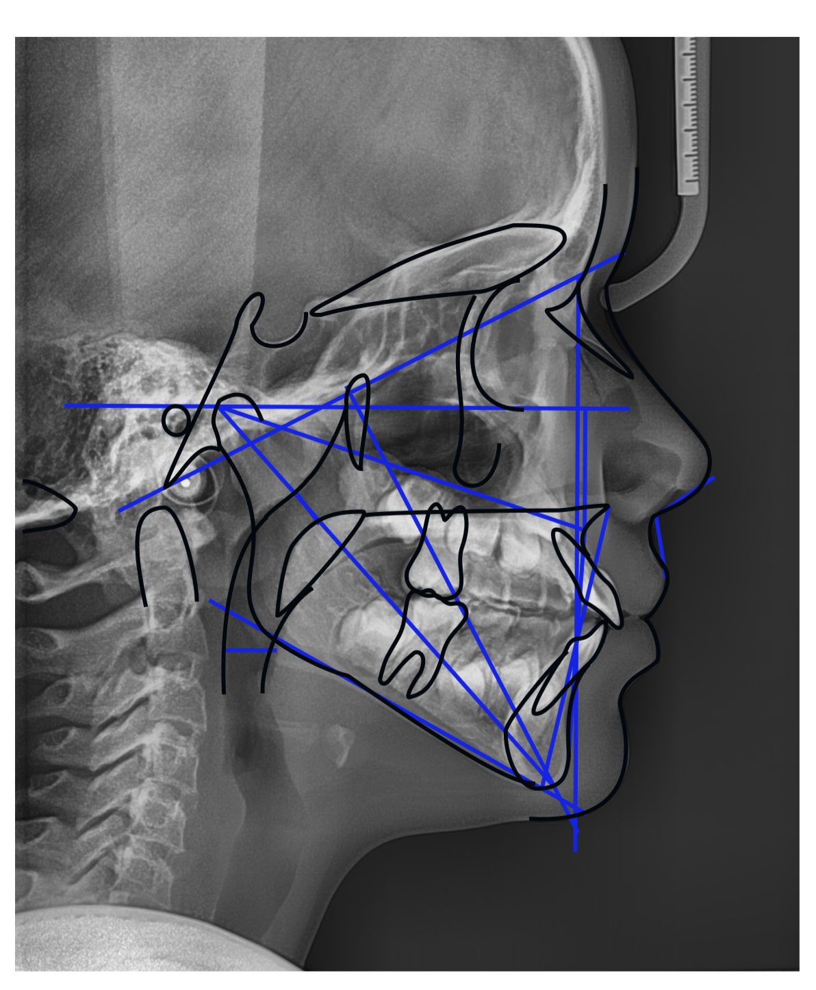 Radiografia